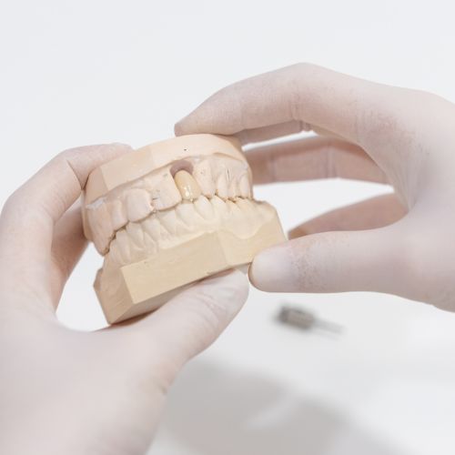 dental implant idim